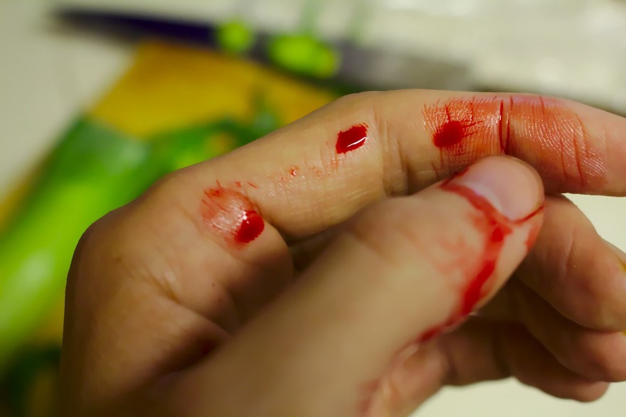 Cleaning a wound in a survival situation