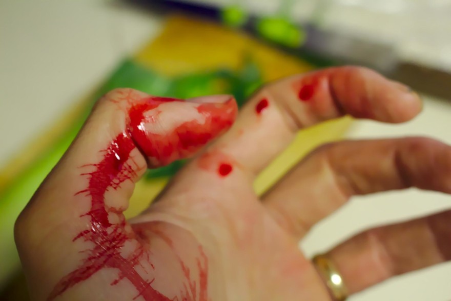 Stick your next cut shut with super glue